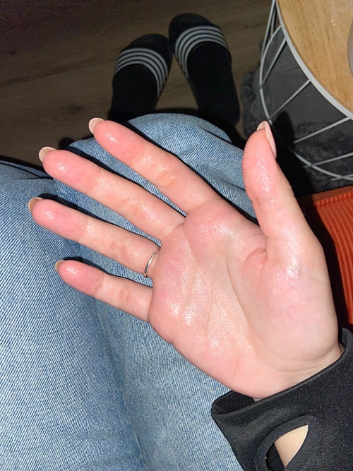 Natte handen 2 Natte handen